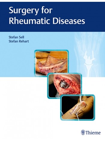 Surgery for Rheumatic Diseases
